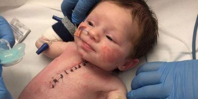 ČUDESNO Beba stara samo tjedan dana preživjela operaciju srca
