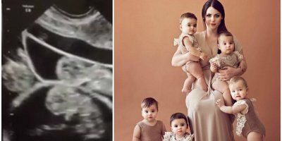Majka petorki: Doznala sam da nosim petoro djece, liječnici su mi predložili selektivni abortus… Nikada to ne bih mogla učiniti