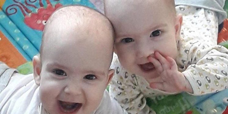 Prve hrvatske sijamske blizanke, obaraju s nogu svojim osmjehom