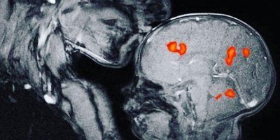 ZAŠTO SU MAJČINI POLJUPCI NEZAMJENJIVI? Znanstvenica se iz čiste znatiželje slikala s djetetom na uređaju za magnetsku rezonancu. Otkrila je kako ljubav utječe na razvoj mozga