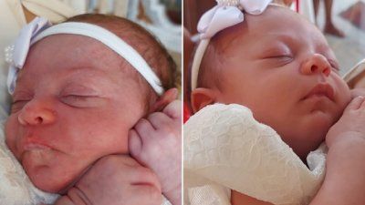 Zadivljujuće fotografije krštenja &quot;prije i poslije&quot; postale viralne